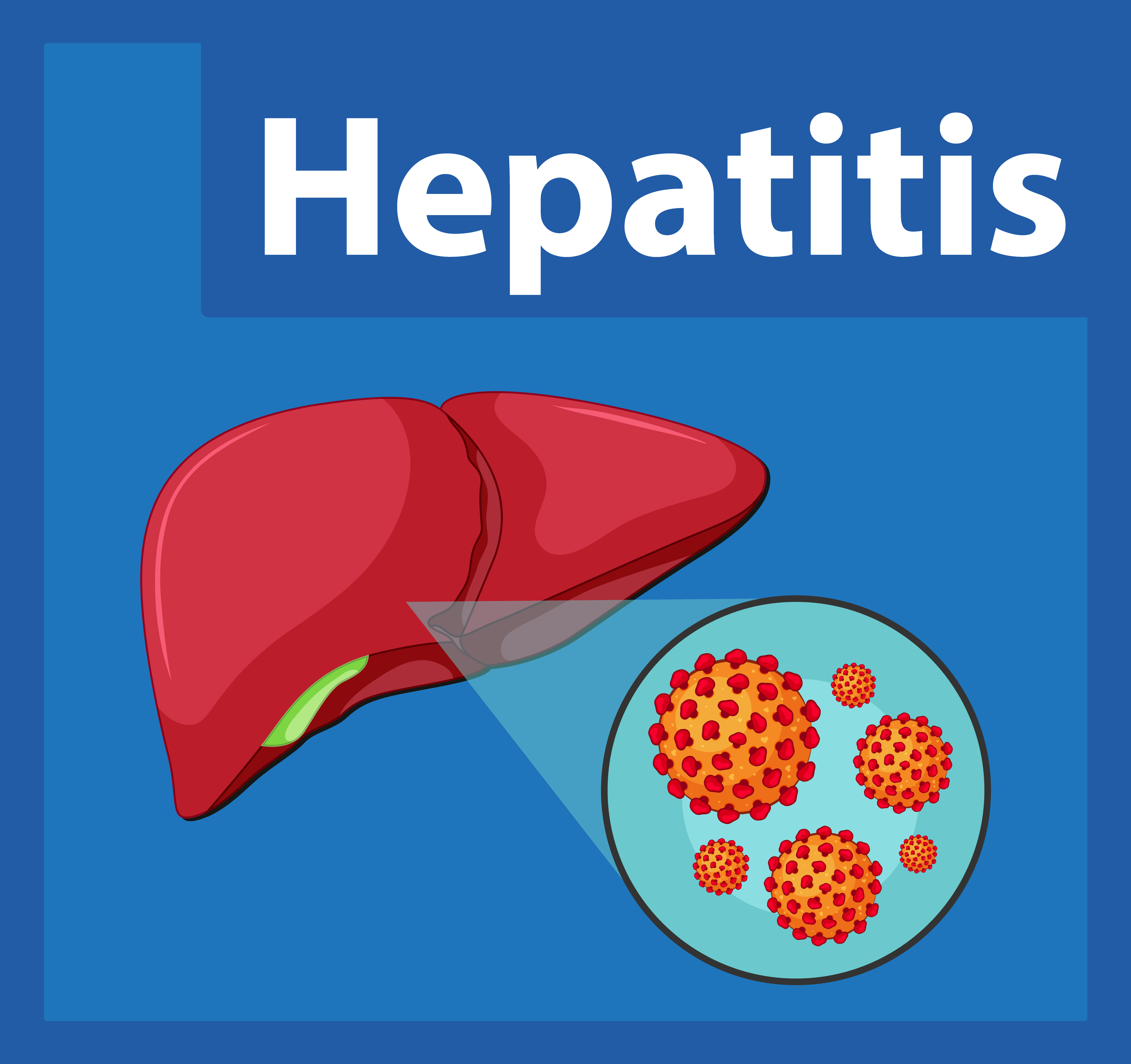 hepatitis